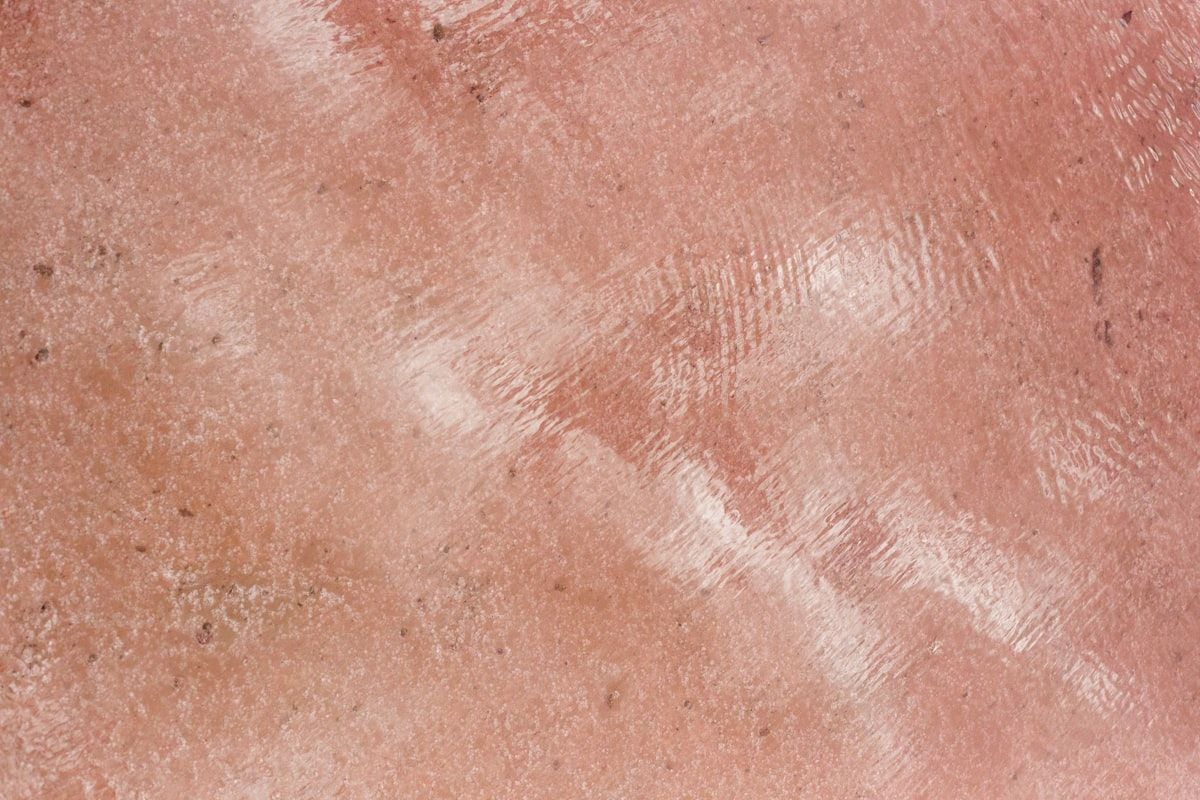 A close-up view of a forearm with several small red itchy bumps grouped in a loose line, alongside a bed with rumpled white sheets and a mattress seam visible in the background